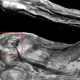 Image for article titled Anthropologists Have Mapped All 61 Tattoos On Ötzi The Iceman